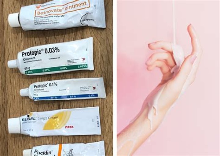 Best eczema cream - How To Discuss