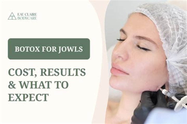 Botox for jowls - How To Discuss