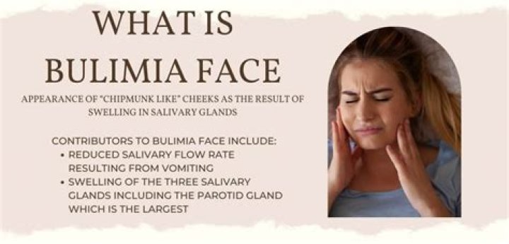 Bulimia face - How To Discuss