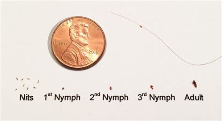 Can lice live in the washing machine