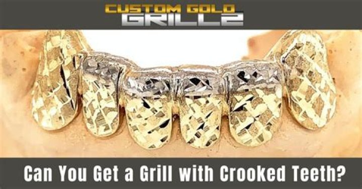 Can You Get A Grill With Crooked Teeth