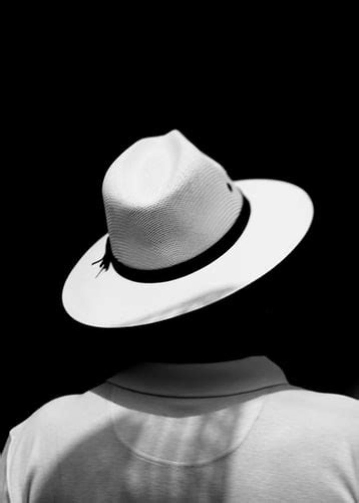 Can you go bald from wearing a hat?