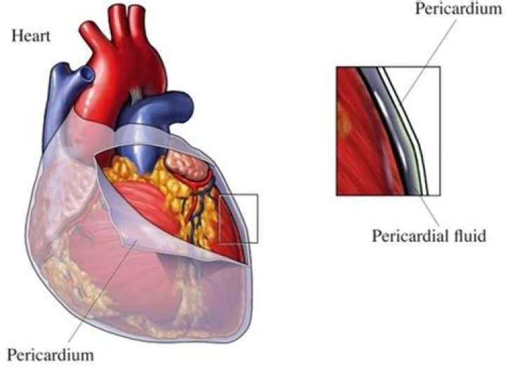 Double Walled Sac Which Encloses The Heart
