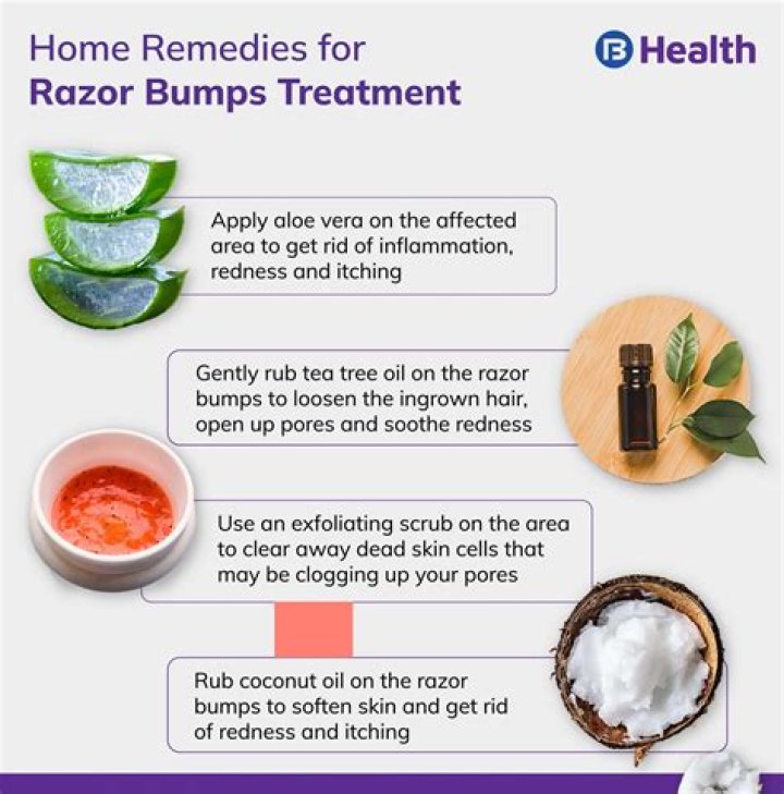 How to get rid of razor bumps down there