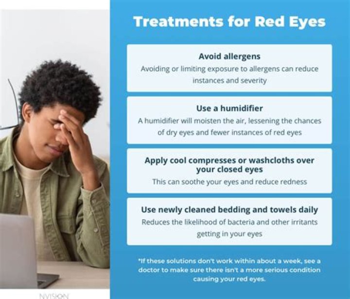 How to get rid of red eyes without eye drops