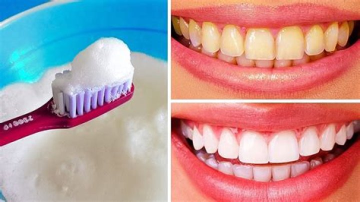 How to whiten teeth at home in one day