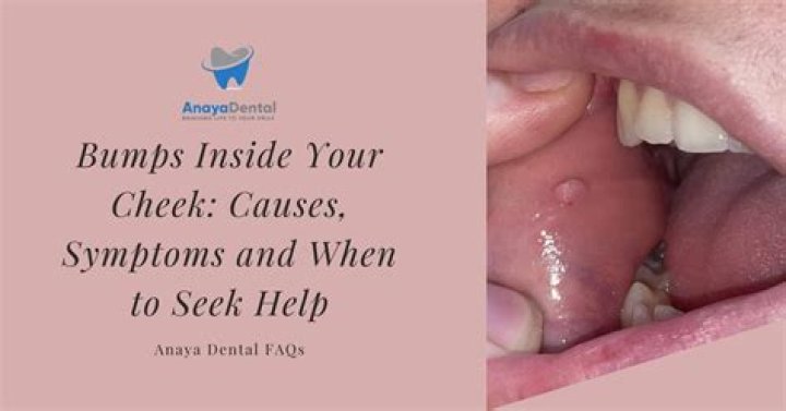 What are the bumps on my earlobes