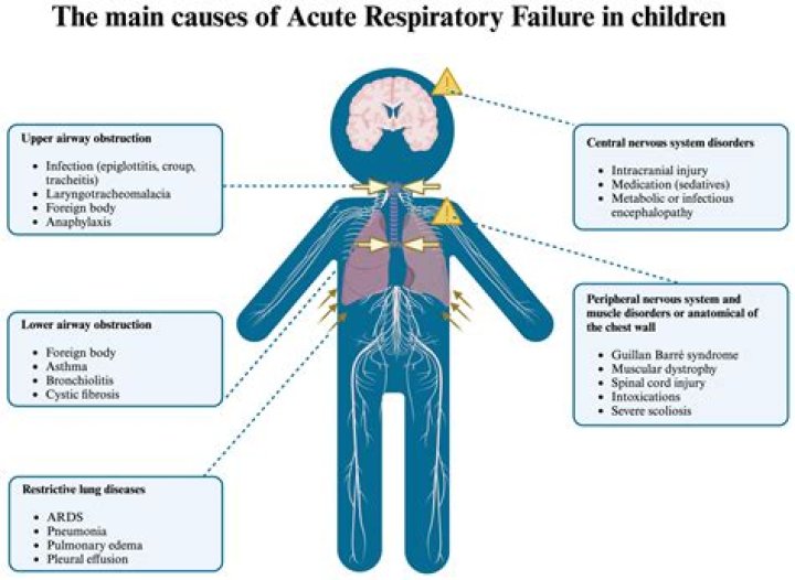 What are the clinical indicators of acute respiratory failure