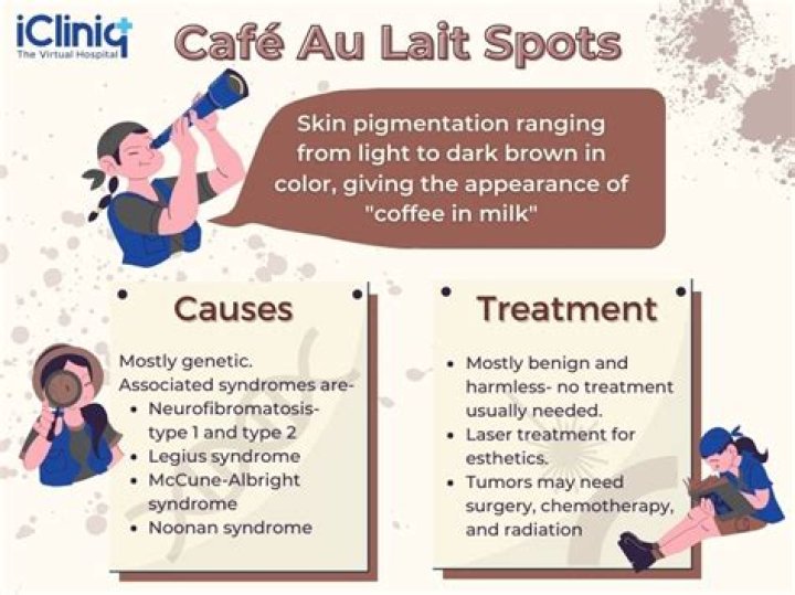 What causes cafe au lait spots