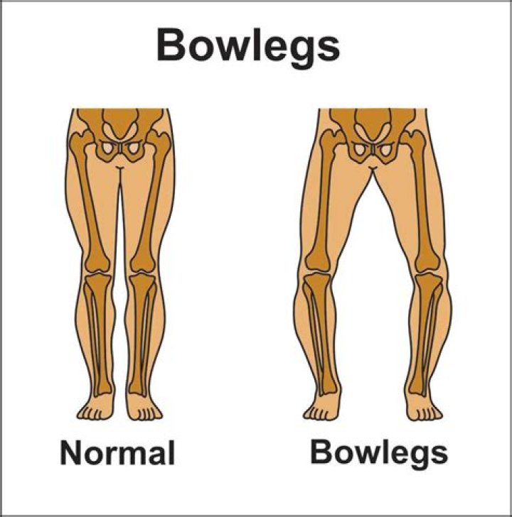 What does bow tie mean in slang?