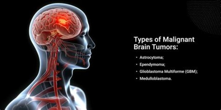 What is a highly malignant brain tumor
