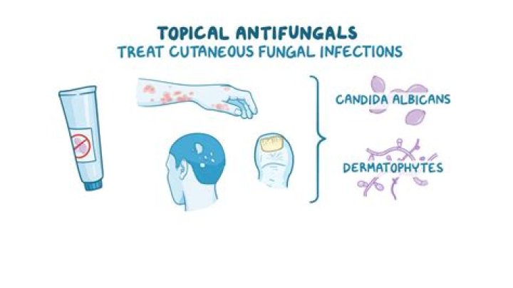 What is a topical antifungal