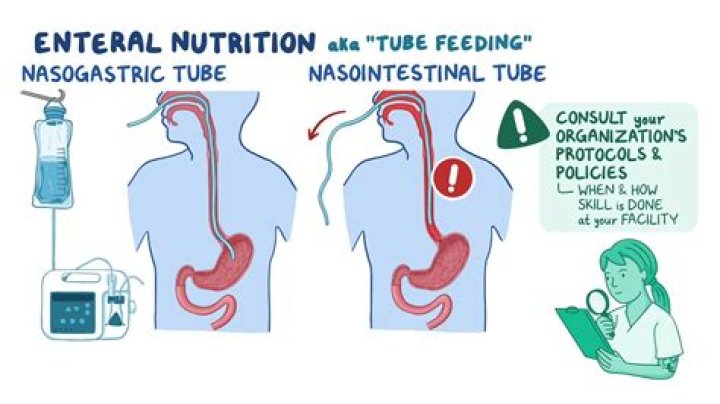 What kind of tube is used to decompress the stomach or as a means of feeding the patient