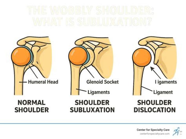 What to do if your shoulder is cracking?